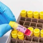 ഓ​സ്‌​ട്രേ​ലി​യ​ന്‍ ആ​ഭ്യ​ന്ത​ര മ​ന്ത്രി പീ​റ്റ​ര്‍ ഡ​ട്ട​നും കൊ​റോ​ണ സ്ഥിരീകരിച്ചു