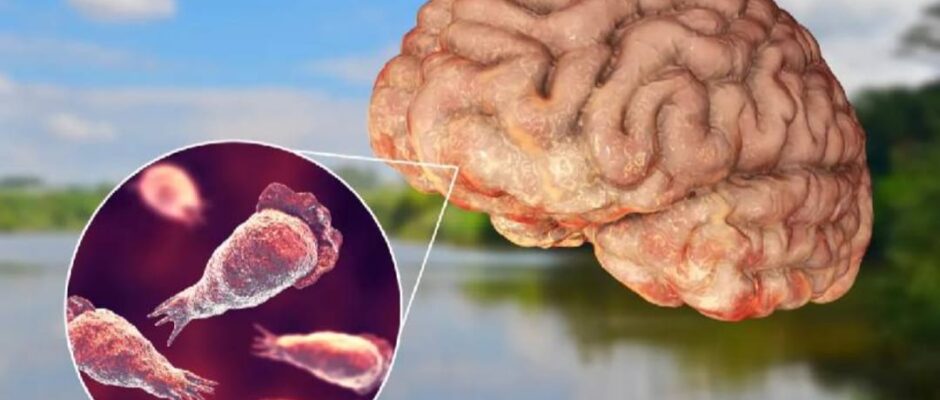 11 വയസ്സുകാരന് അമീബിക് മസ്തിഷ്ക ജ്വരം;