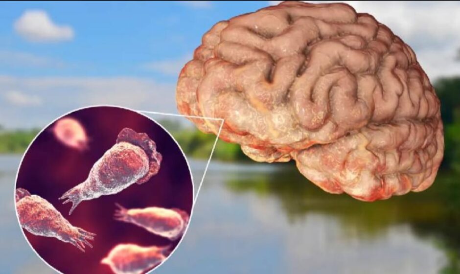 11 വയസ്സുകാരന് അമീബിക് മസ്തിഷ്ക ജ്വരം;