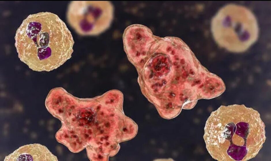 കോഴിക്കോട് ജില്ലയിൽ അമീബിക് മസ്തിഷ്കജ്വര കേസുകൾ വർദ്ധിക്കുന്നു: