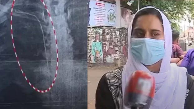 തിരുവനന്തപുരം ജനറൽ ആശുപത്രിയിൽ ശസ്ത്രക്രിയ പിഴവ്; ട്യൂബ് നെഞ്ചിൽ കുടുങ്ങി