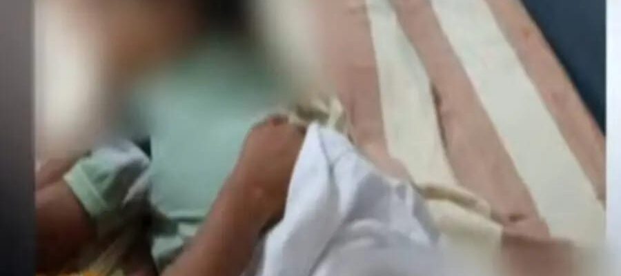 ഞെട്ടിക്കുന്ന ശിക്ഷ: കുഞ്ഞിനെ ചട്ടുകം കൊണ്ട് പൊള്ളിച്ചു;