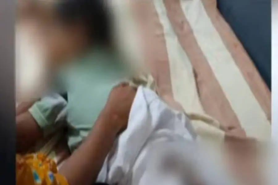 ഞെട്ടിക്കുന്ന ശിക്ഷ: കുഞ്ഞിനെ ചട്ടുകം കൊണ്ട് പൊള്ളിച്ചു; കായംകുളത്ത് അമ്മ അറസ്റ്റിൽ