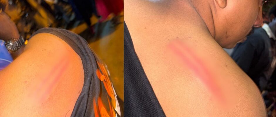 ആഘോഷം സംഘർഷത്തിൽ കലാശിച്ചു;