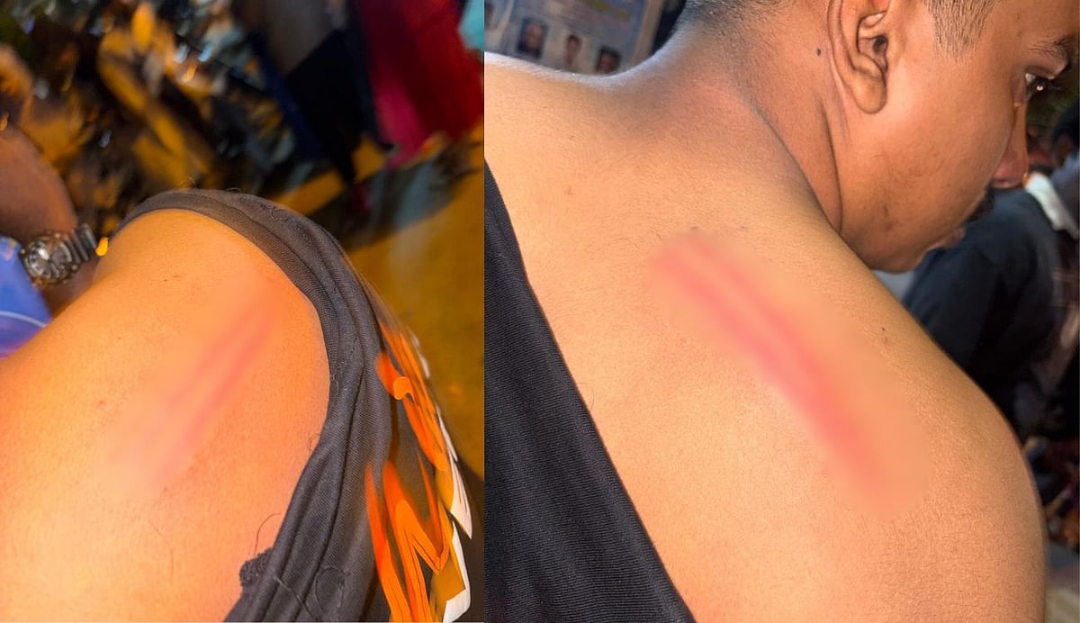 ആഘോഷം സംഘർഷത്തിൽ കലാശിച്ചു: ശംഖുമുഖത്ത് വിദ്യാർത്ഥികൾക്ക് നേരെ പൊലീസ് ലാത്തിച്ചാർജ്